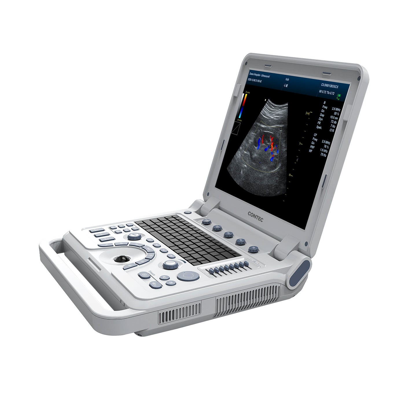 VET Veterinary Portable Ultrasound Scanner Laptop Machine Color Doppler For Pregnancy In Animals