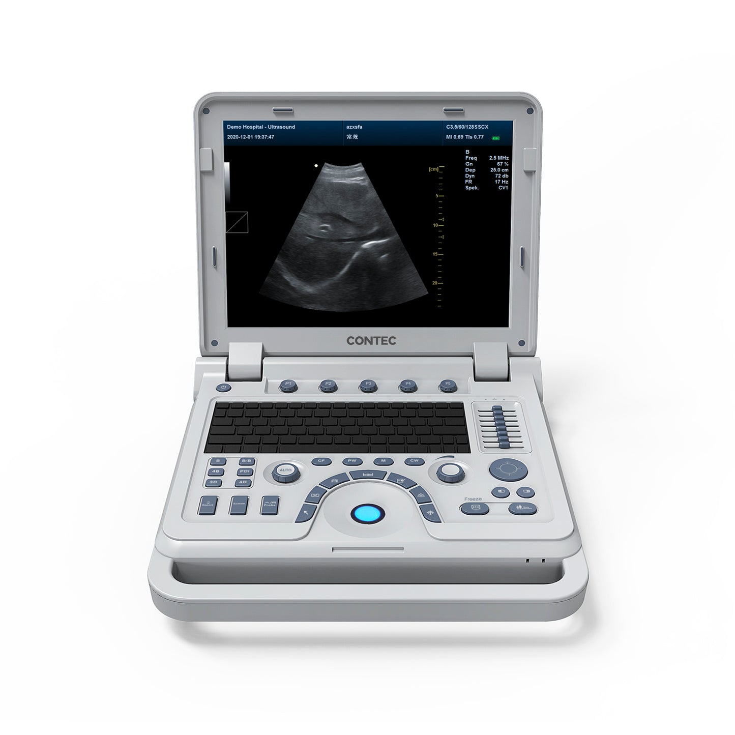 VET Veterinary Portable Ultrasound Scanner Laptop Machine Color Doppler For Pregnancy In Animals